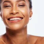 visage d'une femme souriante après traitement par thermage