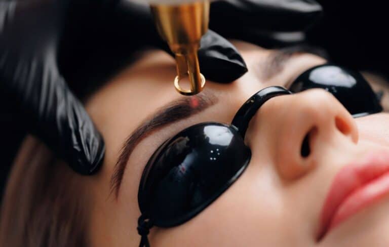 visage d'une femme recevant un traitement de détatouage des sourcils par picolaser